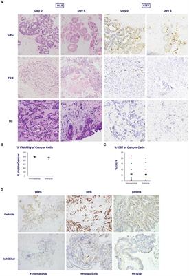 A clinical evaluation of an ex vivo organ culture system to predict patient response to cancer therapy